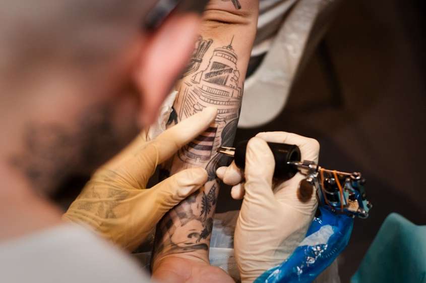 Come Si Rimuove Un Tatuaggio Prima Pagina Online